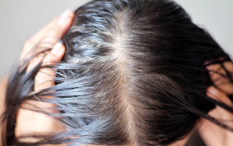 Tại sao tóc bết dính sau khi gội đầu  Cách khắc phục thế nào