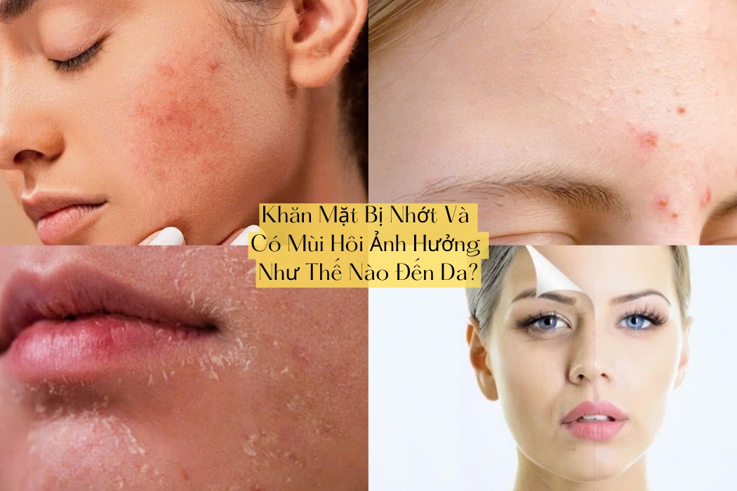 Khăn Mặt Bị Nhớt Và Có Mùi Ảnh Hưởng Như Thế Nào Đến Da? Khăn mặt bị nhớt và có mùi ảnh hưởng như thế nào đến da?