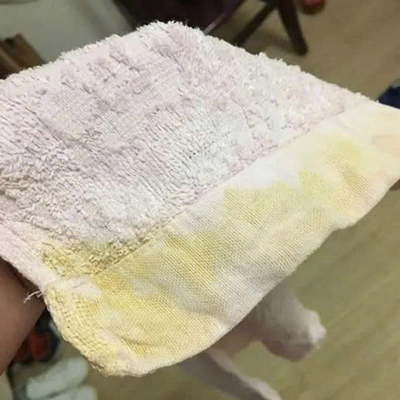 Tác Hại Của Việc Sử Dụng Khăn Tắm Bị Mốc Tác hại của việc sử dụng khăn tắm bị mốc